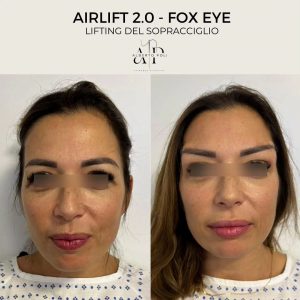 Airlift 2.2 Fox Eye