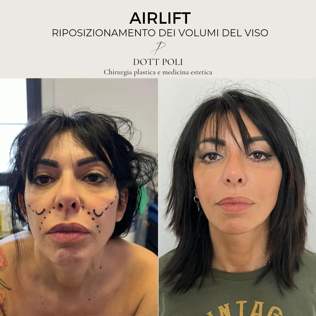 Dott Alberto Poli