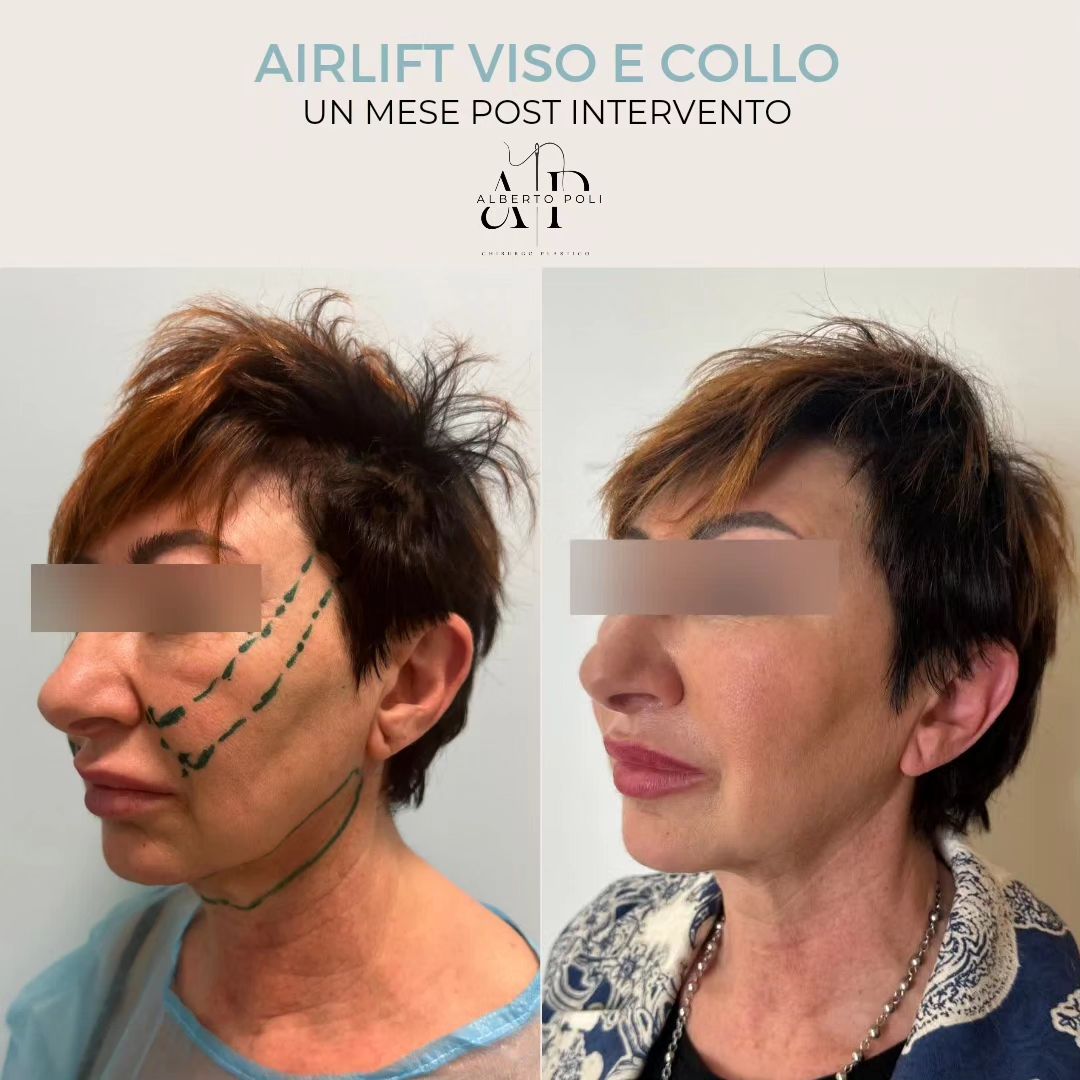 dott poli chirurgo estetico