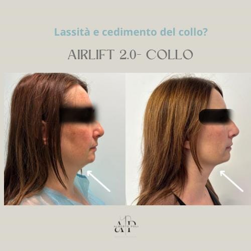 AIR LIFT Alberto Poli Milano
