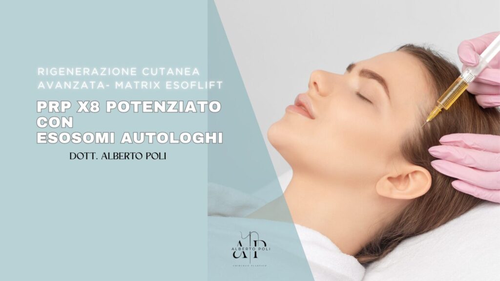 PRP x8 Potenziato con Esosomi Autologhi